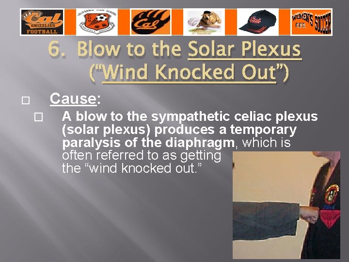 6. Blow to the Solar Plexus (“Wind Knocked Out”) Cause: � � A blow