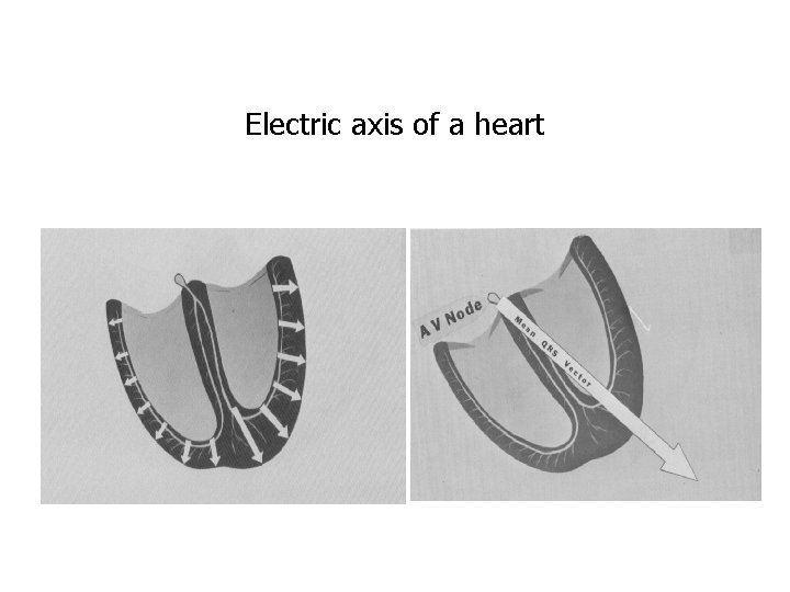 Electric axis of a heart 