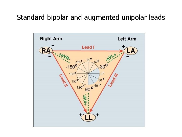 Standard bipolar and augmented unipolar leads 