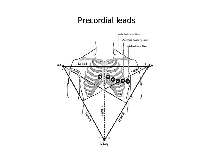 Precordial leads 