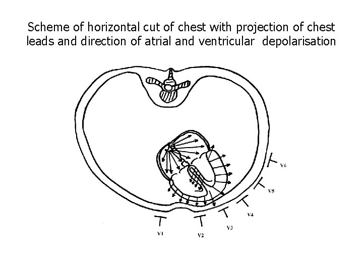 Scheme of horizontal cut of chest with projection of chest leads and direction of