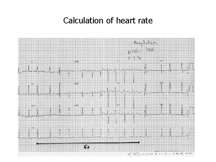 Calculation of heart rate 