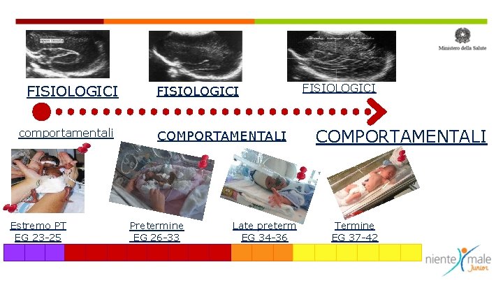 FISIOLOGICI comportamentali Estremo PT EG 23 -25 FISIOLOGICI COMPORTAMENTALI Pretermine EG 26 -33 Late