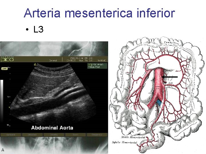 Arteria mesenterica inferior • L 3 