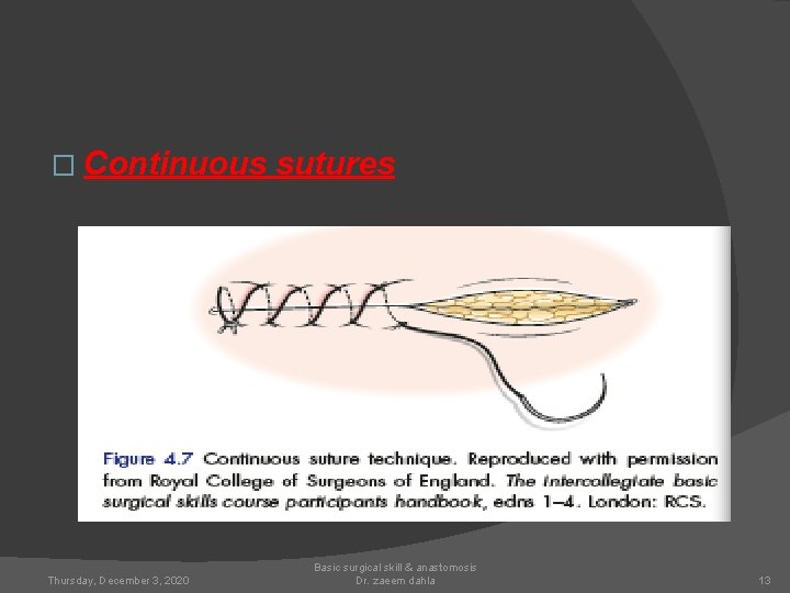 � Continuous Thursday, December 3, 2020 sutures Basic surgical skill & anastomosis Dr. zaeem
