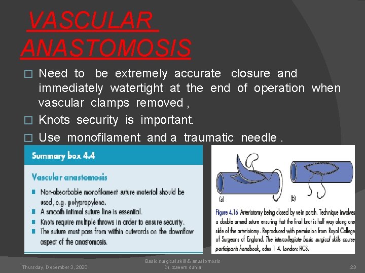 VASCULAR ANASTOMOSIS Need to be extremely accurate closure and immediately watertight at the end