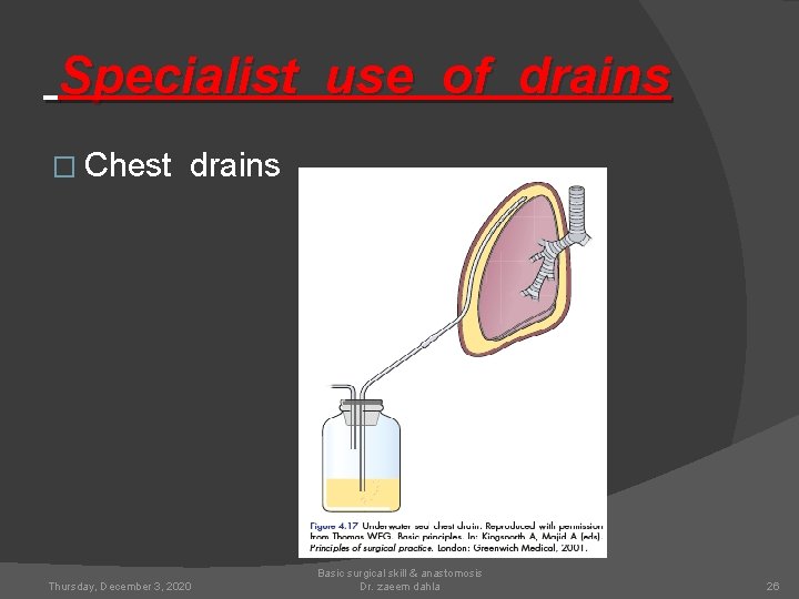 Specialist use of drains � Chest drains Thursday, December 3, 2020 Basic surgical skill