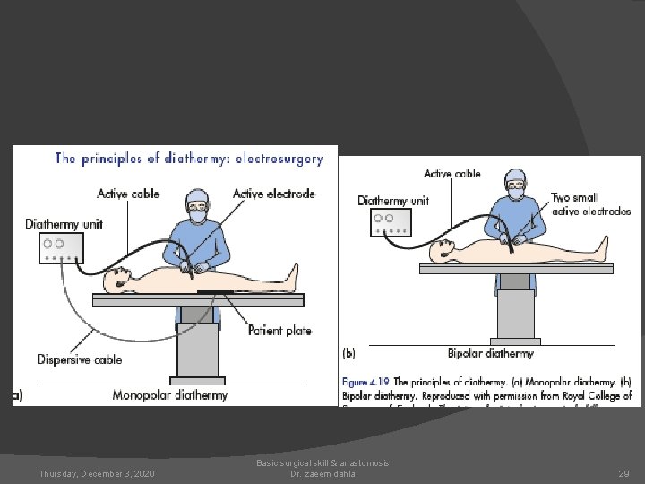 Thursday, December 3, 2020 Basic surgical skill & anastomosis Dr. zaeem dahla 29 