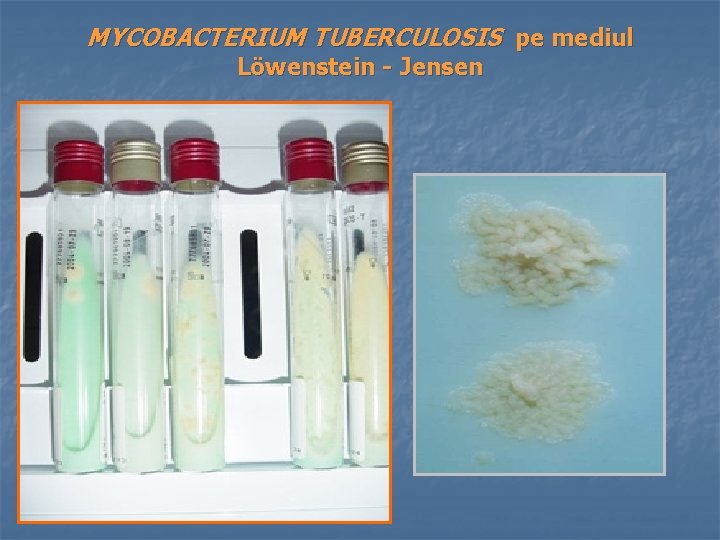 MYCOBACTERIUM TUBERCULOSIS pe mediul Löwenstein - Jensen 