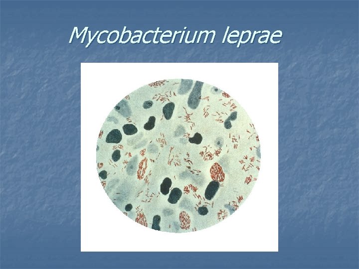 Mycobacterium leprae 