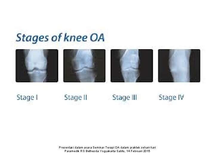Presentasi dalam acara Seminar Terapi OA dalam praktek sehari-hari Paramedik RS Bethesda Yogyakarta Sabtu,