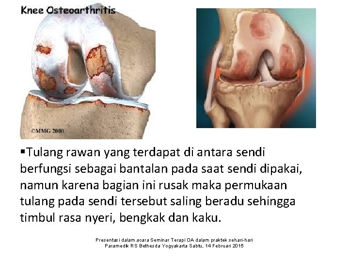 §Tulang rawan yang terdapat di antara sendi berfungsi sebagai bantalan pada saat sendi dipakai,