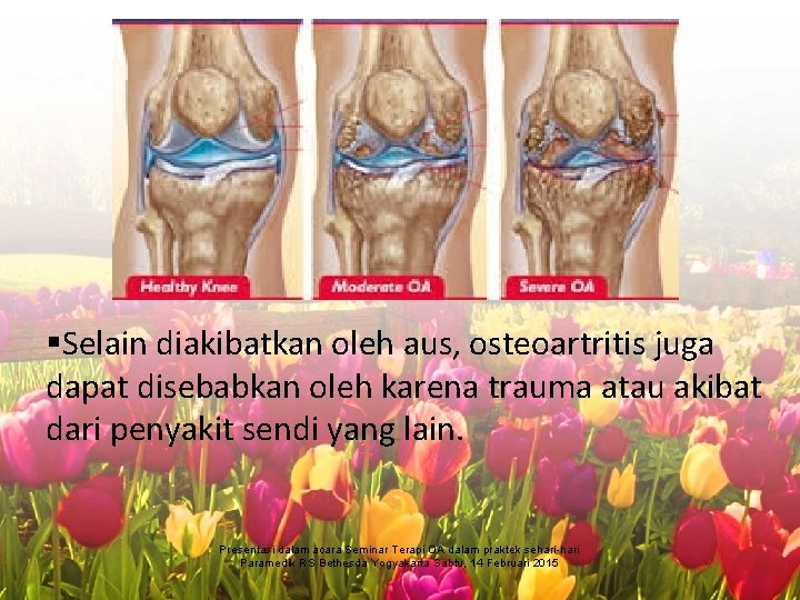 §Selain diakibatkan oleh aus, osteoartritis juga dapat disebabkan oleh karena trauma atau akibat dari