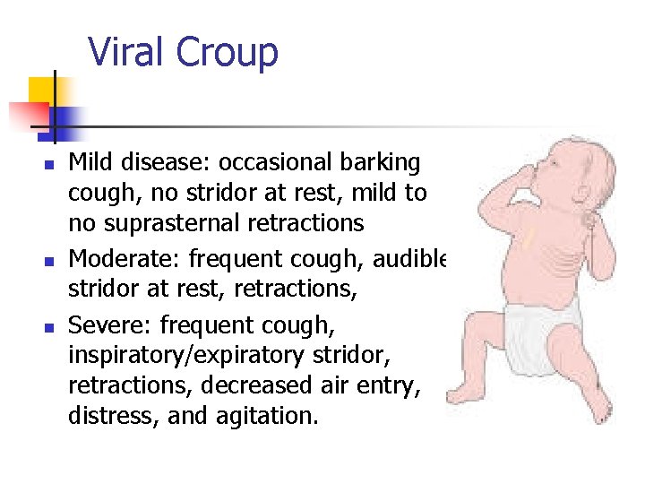 Viral Croup n n n Mild disease: occasional barking cough, no stridor at rest,