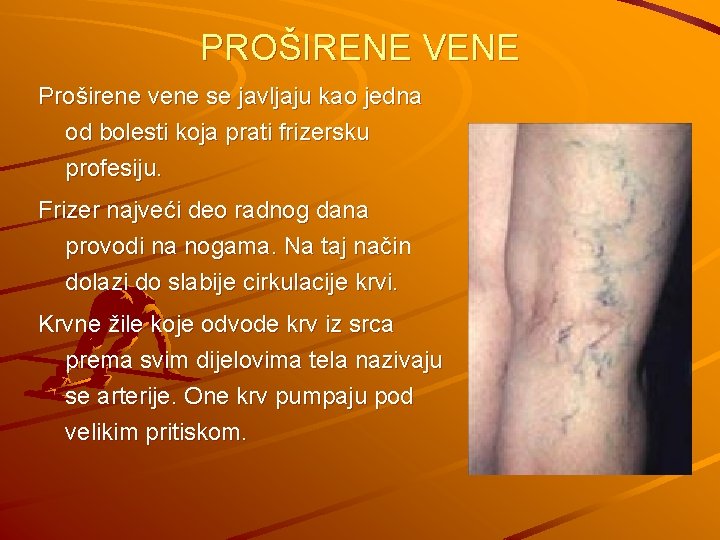 PROŠIRENE VENE Proširene vene se javljaju kao jedna od bolesti koja prati frizersku profesiju.