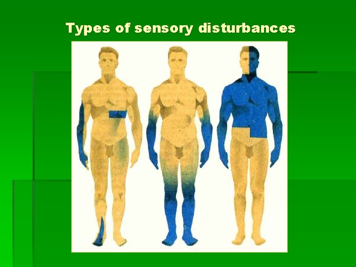 Types of sensory disturbances 