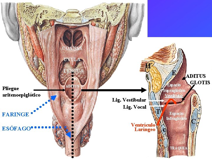 COANAS ÚVULA LENGUA Pliegue aritenoepiglótico H Espacio Supraglótico Vestibular ADITUS Lig. Vestibular Lig. Vocal