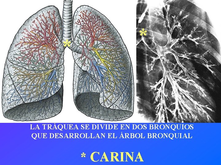 * * LA TRÁQUEA SE DIVIDE EN DOS BRONQUIOS QUE DESARROLLAN EL ÁRBOL BRONQUIAL