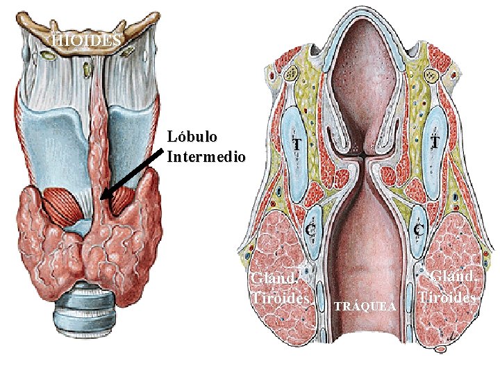 HIOIDES Lóbulo Intermedio. T T C Glánd. Tiroides C TRÁQUEA Glánd. Tiroides 