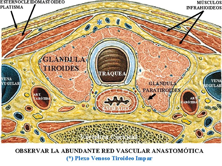 ESTERNOCLEIDOMASTOIDEO PLATISMA MÚSCULOS INFRAHIOIDEOS * GLÁNDULA TIROIDES TRÁQUEA VENA YUGULAR GLÁNDULA PARATIROIDES ART. CARÓTIDA