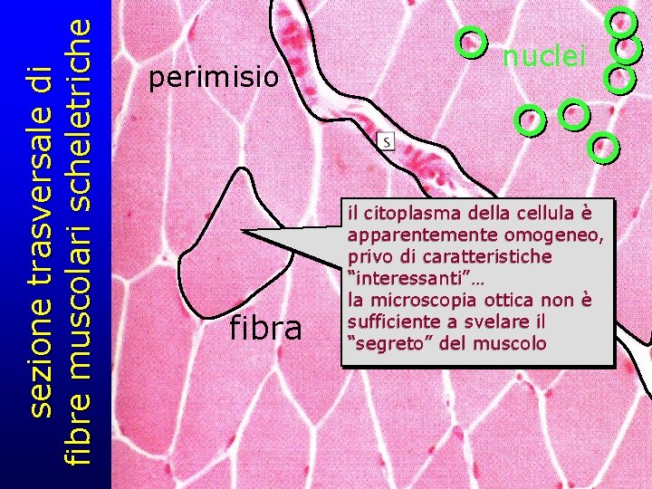 sezione trasversale di fibre muscolari scheletriche perimisio fibra nuclei il citoplasma della cellula è