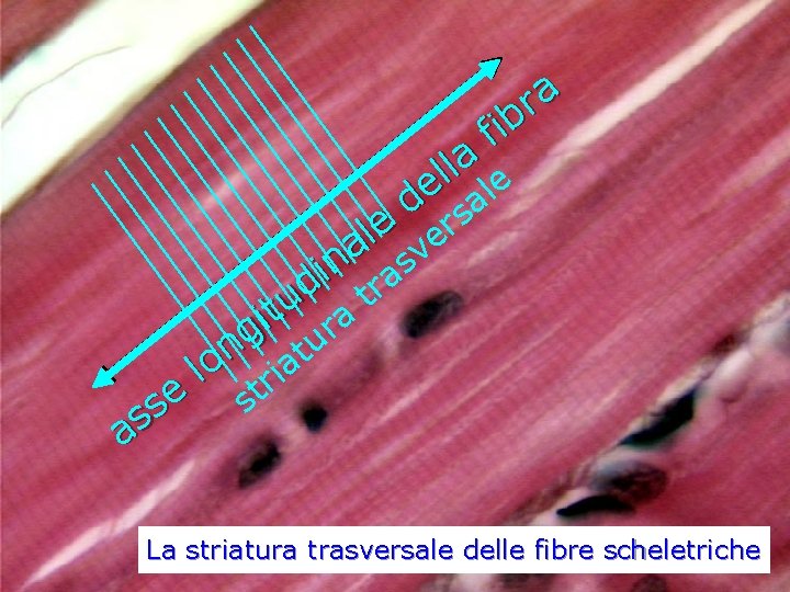 a r fib la e l e d al e s s a s a r fib la e l e d al e s s a s
