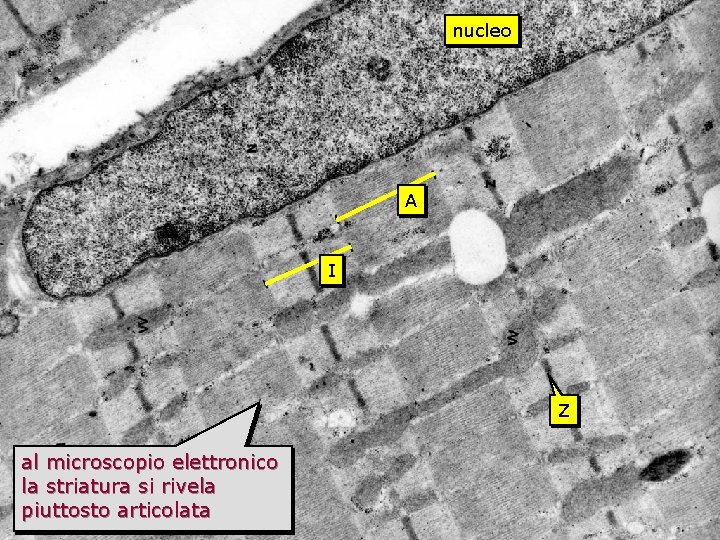 striato TEM nucleo A I Z al microscopio elettronico la striatura si rivela piuttosto striato TEM nucleo A I Z al microscopio elettronico la striatura si rivela piuttosto