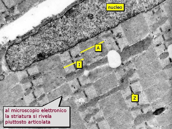 striato TEM nucleo A I Z al microscopio elettronico la striatura si rivela piuttosto