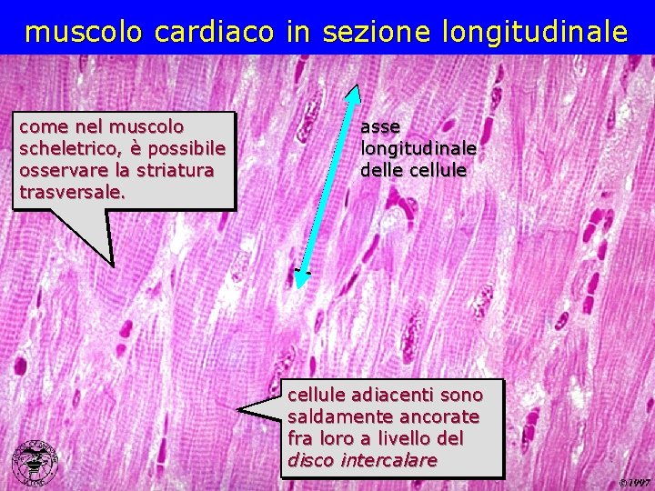 muscolo cardiaco in sezione longitudinale come nel muscolo scheletrico, è possibile osservare la striatura muscolo cardiaco in sezione longitudinale come nel muscolo scheletrico, è possibile osservare la striatura