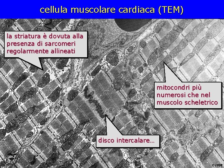 cellula muscolare cardiaca (TEM) la striatura è dovuta alla presenza di sarcomeri regolarmente allineati