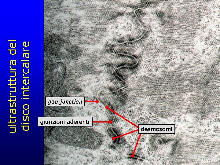 ultrastruttura del disco intercalare gap junction giunzioni aderenti desmosomi 