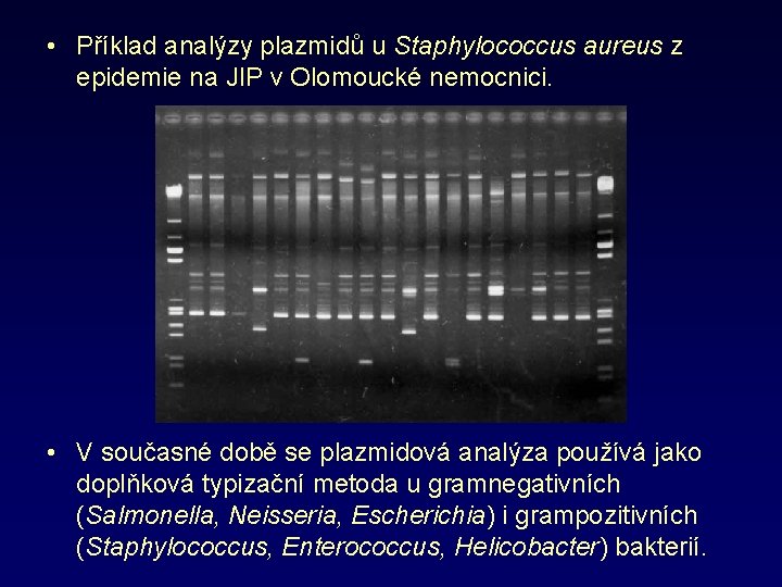  • Příklad analýzy plazmidů u Staphylococcus aureus z epidemie na JIP v Olomoucké