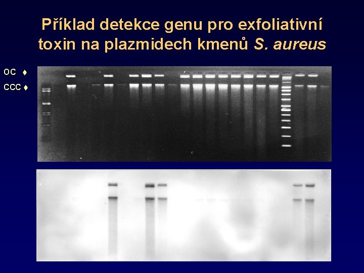 Příklad detekce genu pro exfoliativní toxin na plazmidech kmenů S. aureus OC CCC 