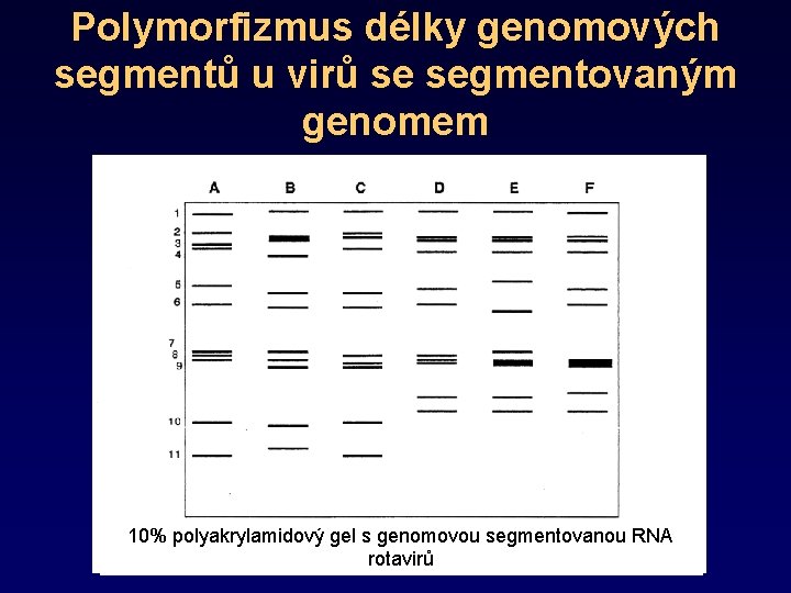 Polymorfizmus délky genomových segmentů u virů se segmentovaným genomem 10% polyakrylamidový gel s genomovou