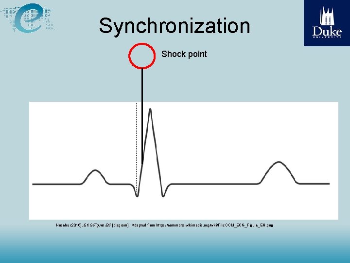 Synchronization Shock point Husche (2015), ECG Figure EN [diagram]. Adapted from https: //commons. wikimedia.