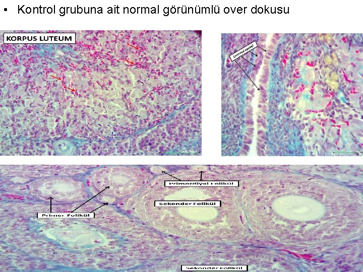  • Kontrol grubuna ait normal görünümlü over dokusu 