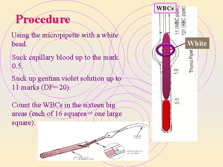 WBCs Procedure Using the micropipette with a white bead. Suck capillary blood up to WBCs Procedure Using the micropipette with a white bead. Suck capillary blood up to
