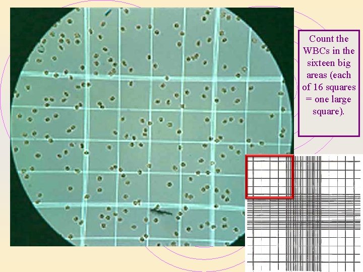 Count the WBCs in the sixteen big areas (each of 16 squares = one Count the WBCs in the sixteen big areas (each of 16 squares = one