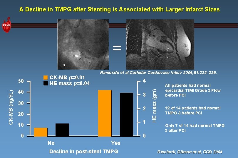 A Decline in TMPG after Stenting is Associated with Larger Infarct Sizes = CK-MB