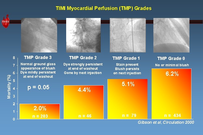 Mortality (%) TIMI Myocardial Perfusion (TMP) Grades TMP Grade 3 TMP Grade 2 TMP