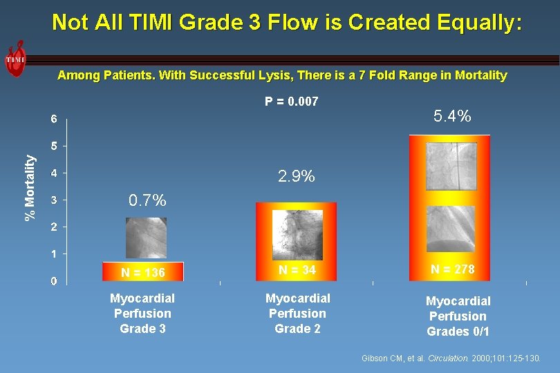 Not All TIMI Grade 3 Flow is Created Equally: Among Patients. With Successful Lysis,