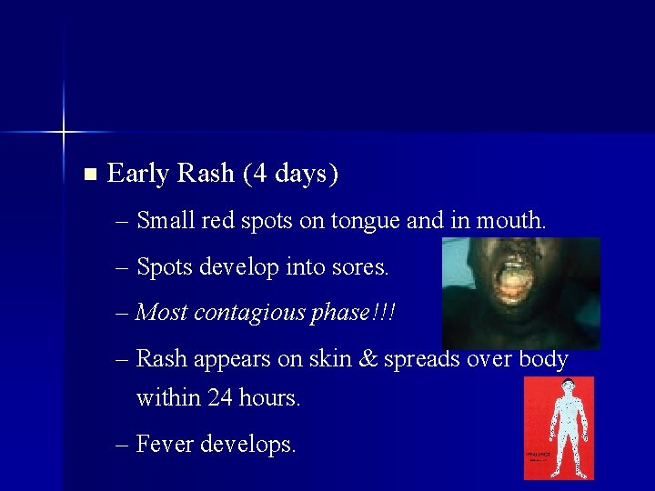 n Early Rash (4 days) – Small red spots on tongue and in mouth.