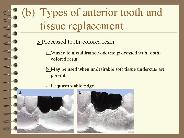(b) Types of anterior tooth and tissue replacement 3 Processed tooth-colored resin a Waxed
