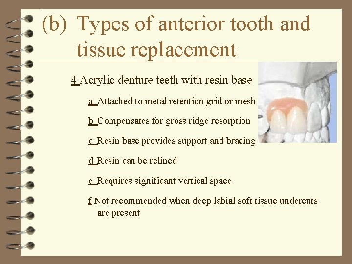 (b) Types of anterior tooth and tissue replacement 4 Acrylic denture teeth with resin
