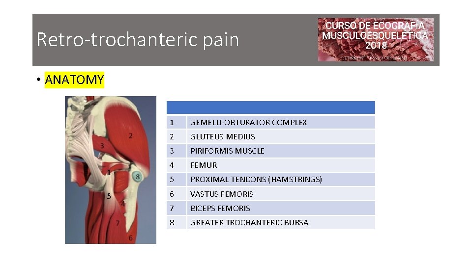 Retro-trochanteric pain • ANATOMY 1 5 1 GEMELLI-OBTURATOR COMPLEX 2 GLUTEUS MEDIUS 3 PIRIFORMIS