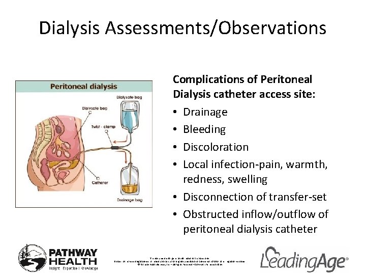 Dialysis Assessments/Observations Complications of Peritoneal Dialysis catheter access site: • Drainage • Bleeding •