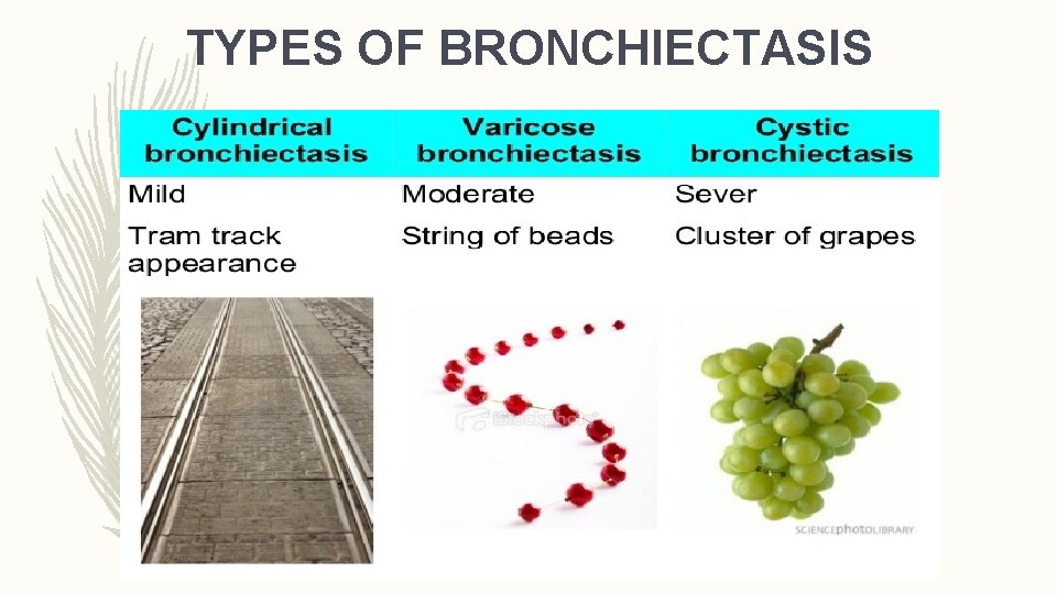 TYPES OF BRONCHIECTASIS 
