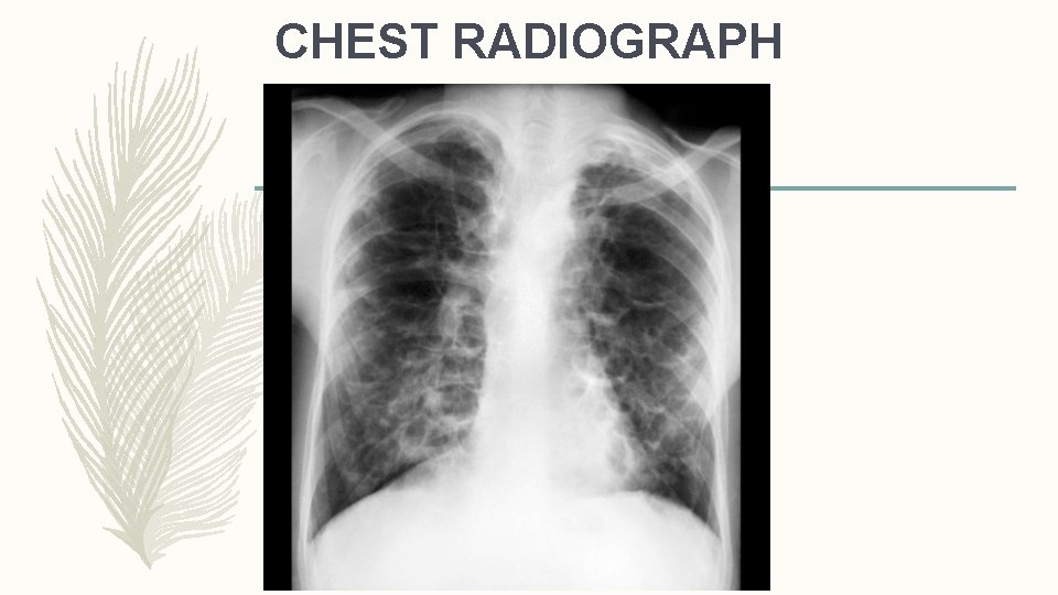 CHEST RADIOGRAPH 