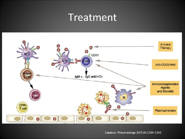 Treatment Saadoun. Rheumatology 2007; 46: 1234– 1242 