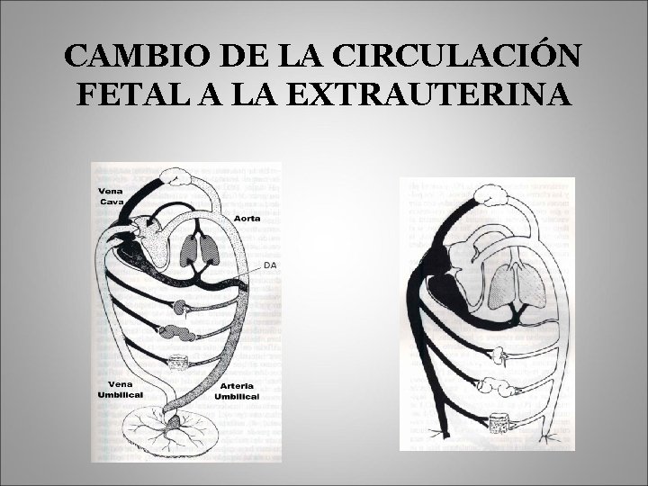 CAMBIO DE LA CIRCULACIÓN FETAL A LA EXTRAUTERINA 